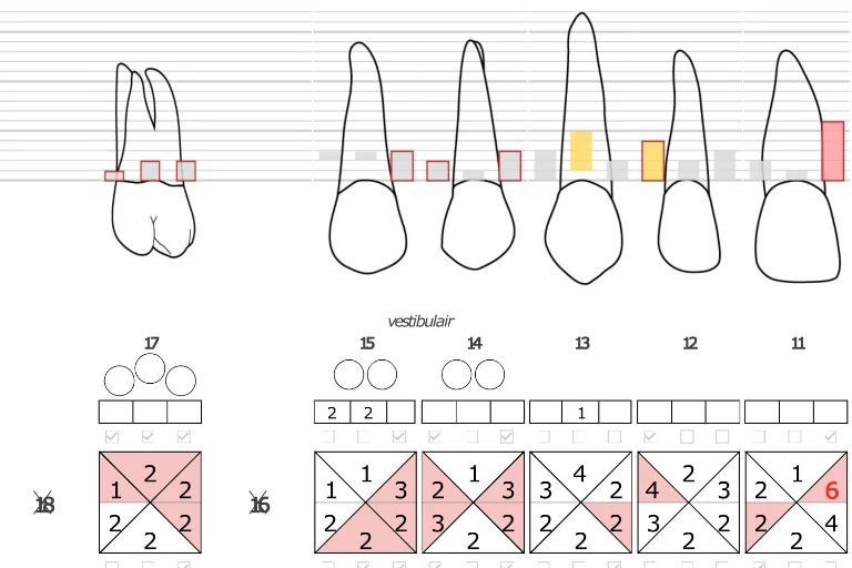 Periodontal chart image