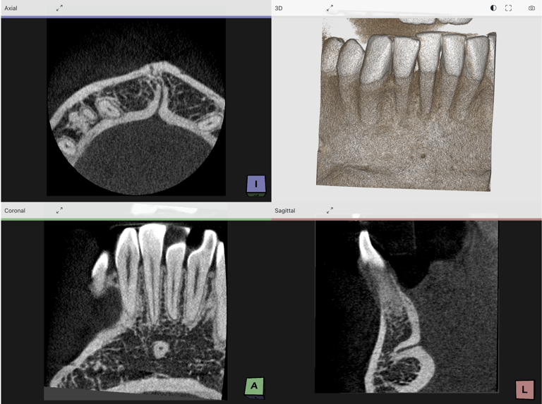 CBCT viewer image